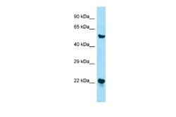ZDHHC12 Rabbit anti-Human, Polyclonal, Novus Biologicals 0.1 mL | Buy Online | Novus Biologicals | Fisher Scientific
